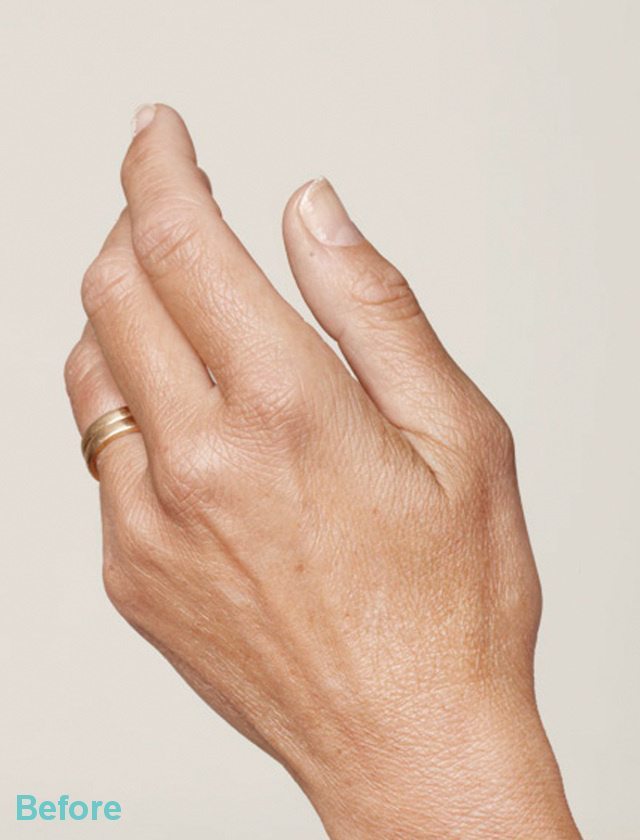 hands before