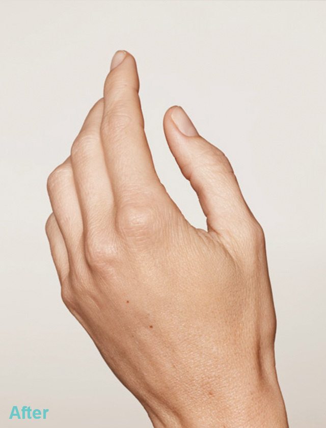 hands after