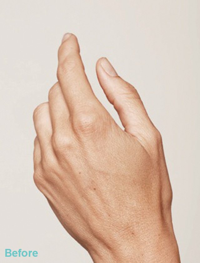 hands before