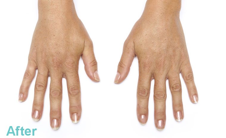 hands after