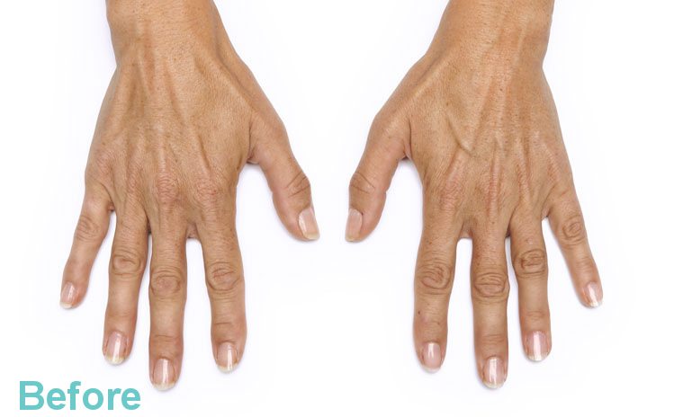 hands before