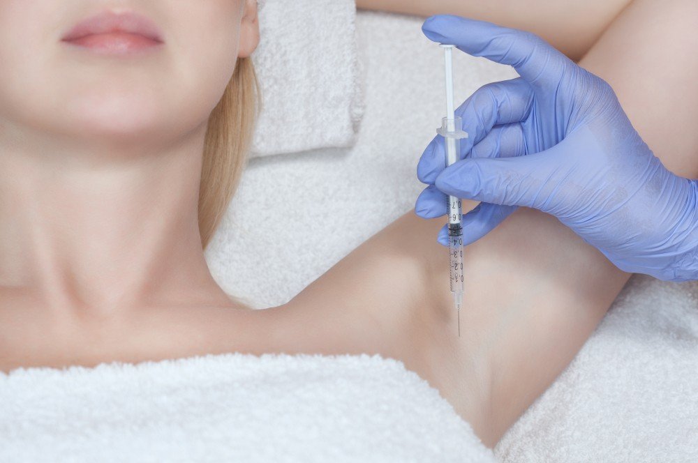 Botox Excessive Forehead & Underarm Sweating at Excellence Medical