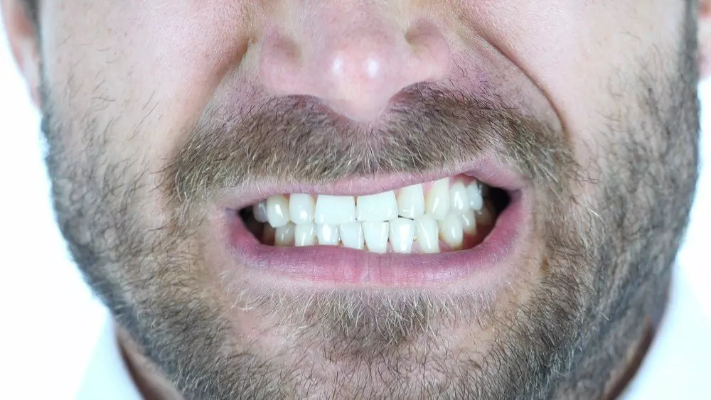 Teeth Grinding Botox Treatment | Excellence Medical Clinic Teeth Grinding Botox Treatment