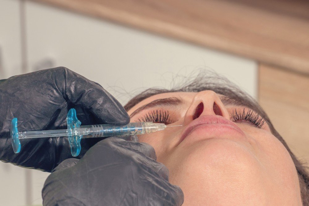 DERMAL FILLER SMOKERS LINES TREATMENT DERMAL FILLER SMOKERS LINES TREATMENT
